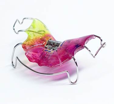 tratament ortodontic la copii 10-11_clip_image002