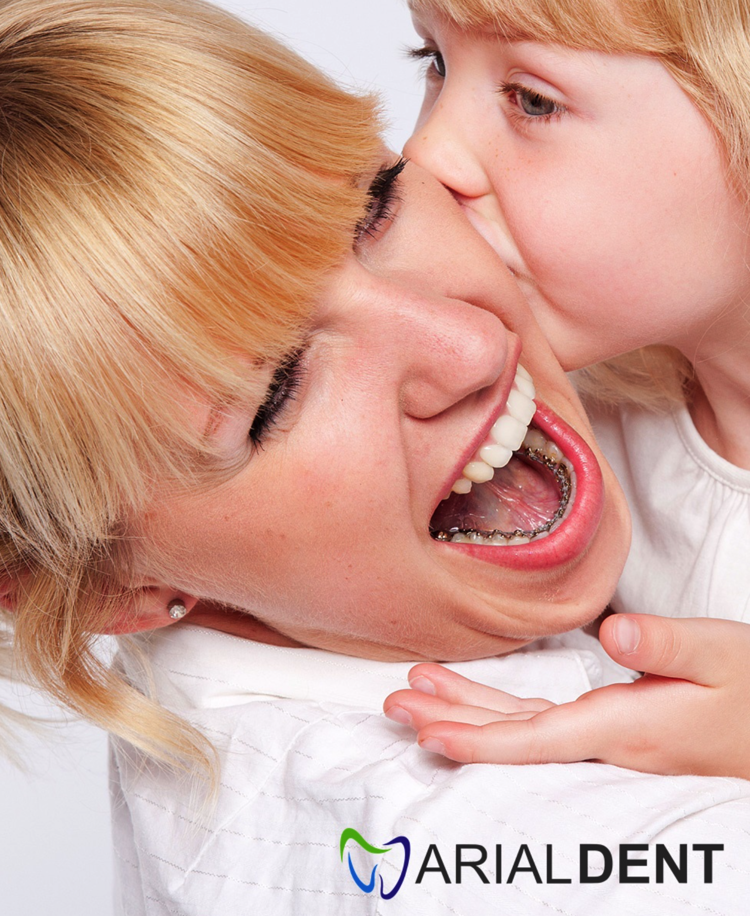 Aparat ortodontic Incognito