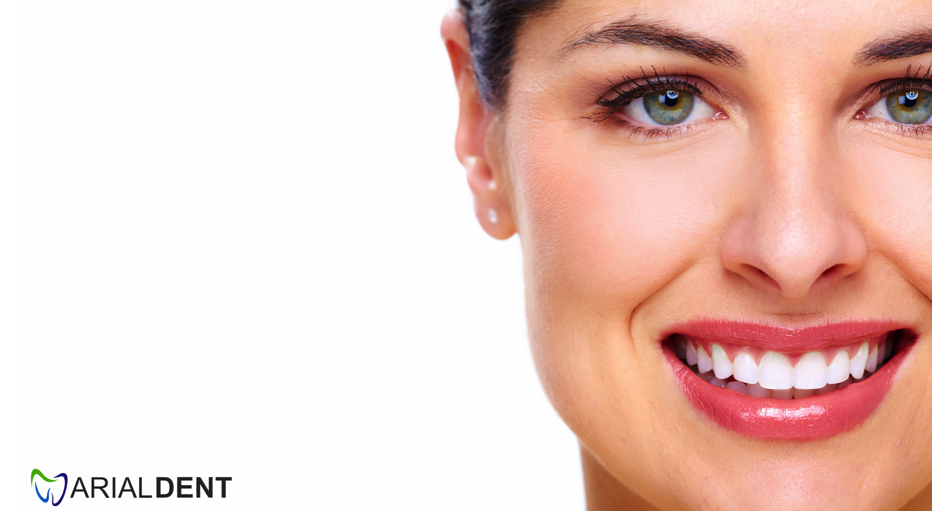 albirea dinților cluj napoca